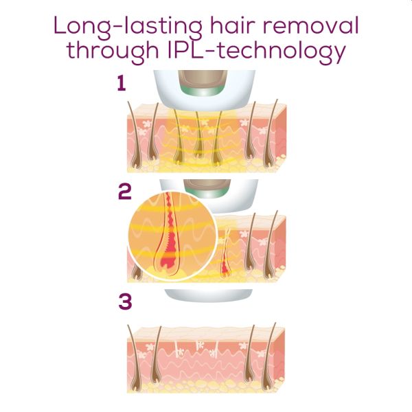 Фотоепилатор Beurer IPL 5800 PureSkin Pro Hair-remover, Auto flash, 3.1 cm2, 600 000 pulses, safe skin sensor, UV filter, 3 energy levels, black